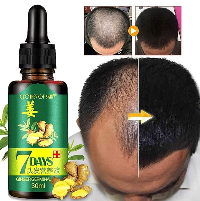 7 Day Ginger Germinal Serum Essence Oil